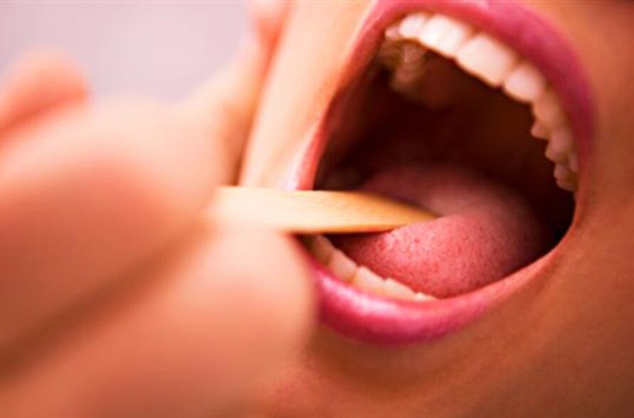 parazitų rūšys žmogaus burnoje